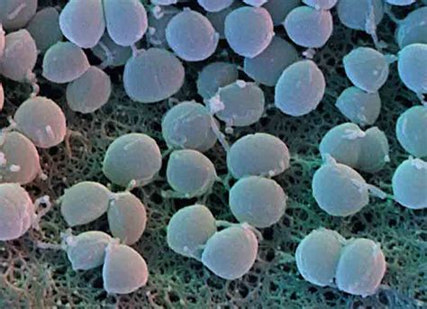 Staphylococcus Aureus Lab Diagnosis And Diseases Medchrome