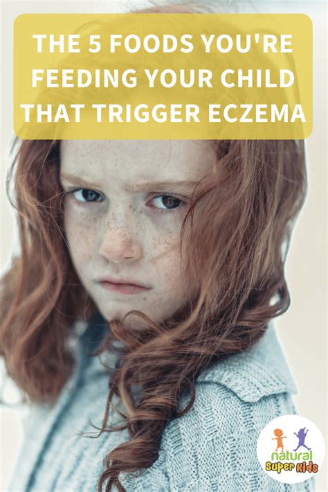 The 5 Foods Youre Feeding Your Child That Trigger Eczema Eczema