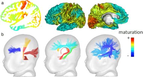Asynchronous Maturation Of Brain Networks Based On Multiparametric Mri