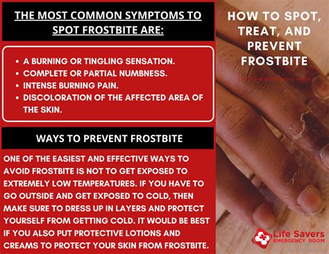 How To Spot Treat And Prevent Frostbite In 2020 With Images Life Savers Prevention