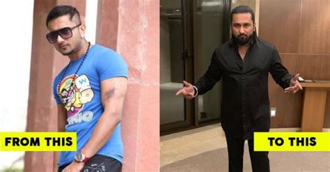 Shocking Transformation Of Yo Yo Honey Singh He Looks Unrecognizable In Latest Pics