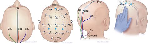 Intraoperative Neuromonitoring Bi Lab