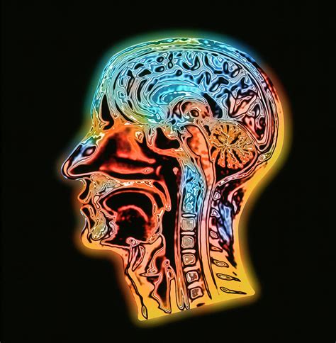 Coloured Mri Scan Of The Human Head Side View Photograph By Alfred