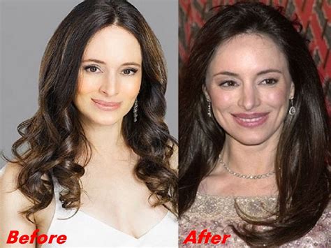 Madeleine Stowe Plastic Surgery Before And After Face Photos 2018