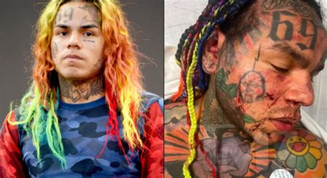 Caught Lackin Tekashi Ix Ine Rushed To Hospital After Being Jumped