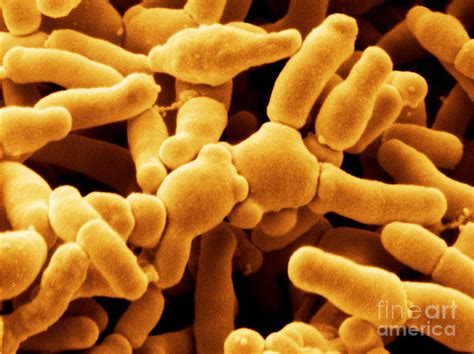 Bifidobacterium Breve Photograph By Scimat