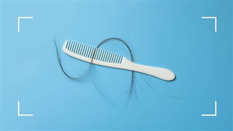 Does Ozempic Cause Hair Loss Doctors Reveal The Truth Woman And Home