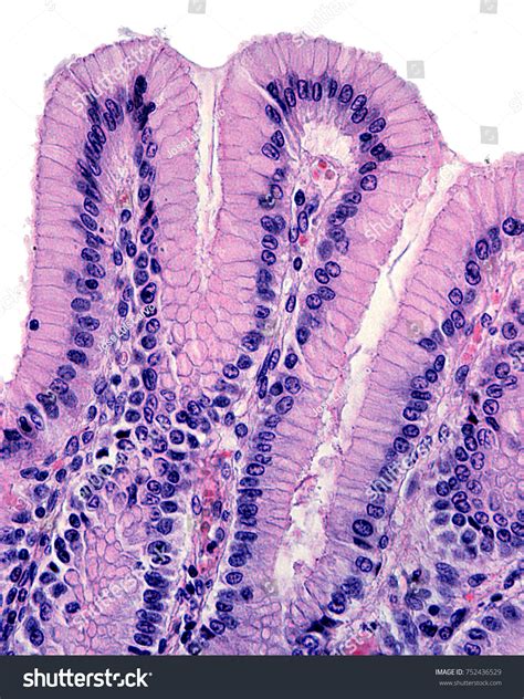 664 Simple Columnar Epithelium Images Stock Photos 3d Objects