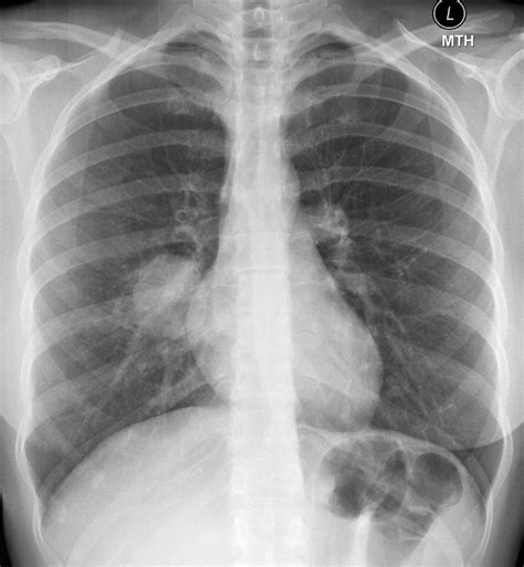 Southwest Journal Of Pulmonary Critical Care And Sleep Imaging