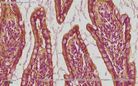 Duodenal Mucosa Histology