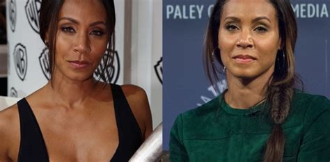 Jada Pinkett Cheek Implants Before And After Facelift