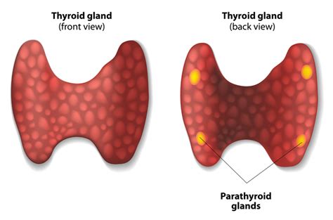 Parathyroidectomy Pictures