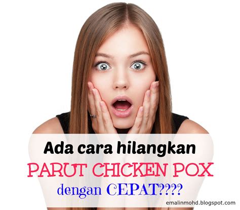 Tak susah pun nak dapatkan aloe vera gel ni. Cara Hilangkan Parut Chicken Pox Dengan Cepat - Healthy is ...