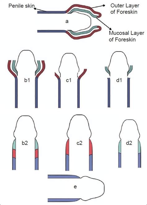 a schematic normal anatomy of uncircumcised human foreskin b1 c1 download scientific