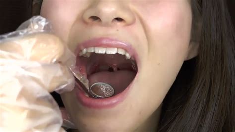 Cute Japanese Girl S Throat And Uvula Youtube