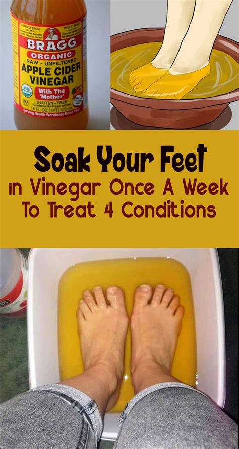 Soak Your Feet In Vinegar Once A Week To Treat These 4 Conditions