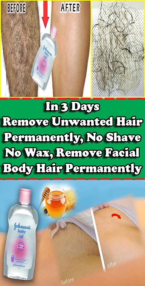 Remove Unwanted Hair Permanently In Three Days No Shave No Wax