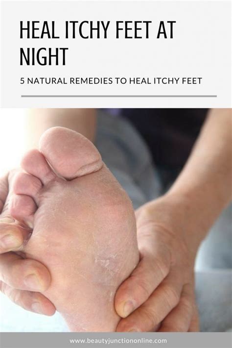 Heal Itchy Feet At Night With 5 Natural Remedies With Images Foot