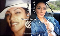 Shantel Jackson Before and After Plastic Surgery photos