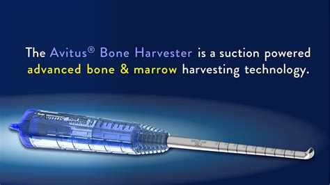 Bone Grafting And Debridement Cancellous Bone Graft Curettage Bone