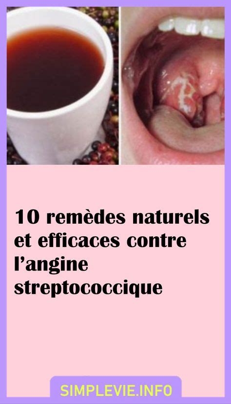 10 remèdes naturels et efficaces contre langine streptococcique