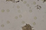 Parasite serology: Amoebiasis – entamoeba histolytica | LSTM