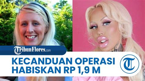 Kecanduan Operasi Plastik Wanita Swedia Habiskan Rp 19 Miliar Agar Mirip Barbie Youtube