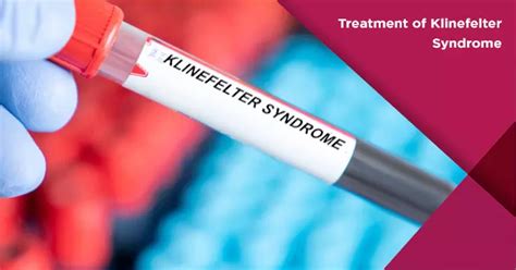 klinefelter syndrome treatment options and effectiveness nova ivf fertility