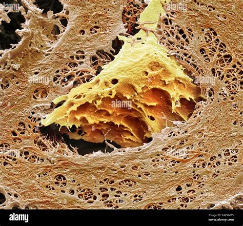 Nasal Cartilage Coloured Scanning Electron Micrograph Sem Of A
