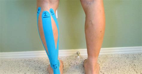 How To Apply Kinesiological Tape When Treating Achilles Tendinitis The Physical Therapy Advisor