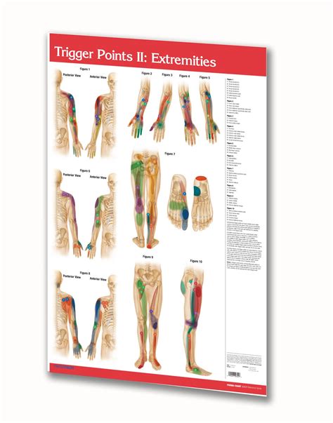 Trigger Points Acupuncture 24 X 36 Laminated Poster Wall Chart