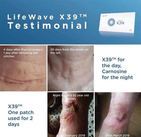 Lifewave X39™ Patches Activate Your Stem Cells Spark Of Life