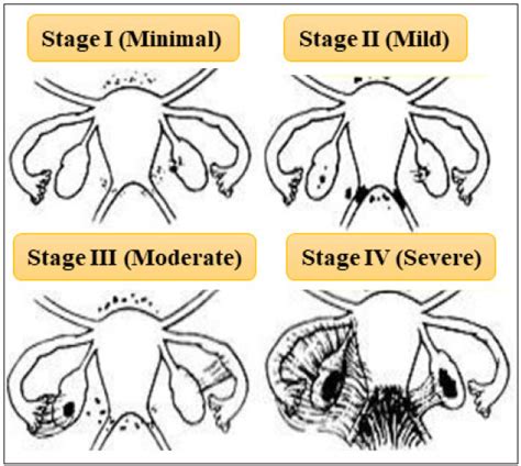 A Primer On Clinical Classification And Pathophysiology Of