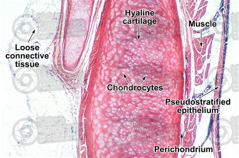 Mammal Trachea Transverse Section X Hyaline Cartilage