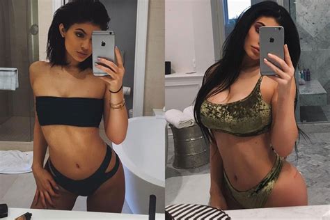 Kylie Jenner Before And After 😱 All Of Her Plastic Surgery