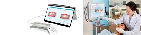 Itero Scanner Digital Dental Impressions Kensington Dental