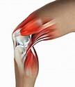 What Is Causing Your Knee Pain?