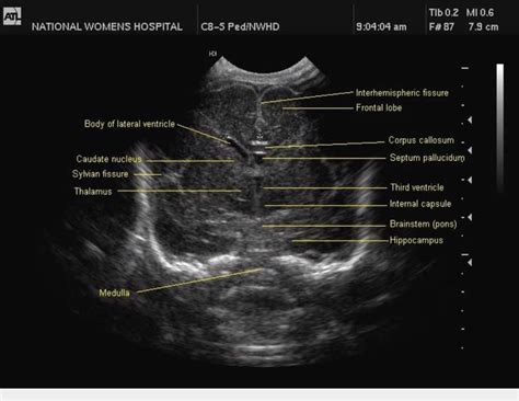 Ultrasound Of Normal Fetal Anatomy Meded Academy Images