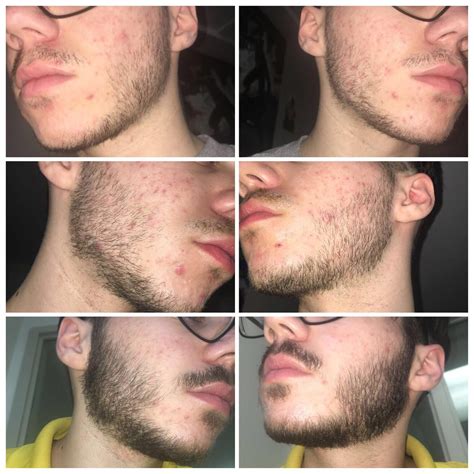 Its use requires patience and dedication to see the results that will impress you it is an important issue that needs to be looked after. Pin on Beard.