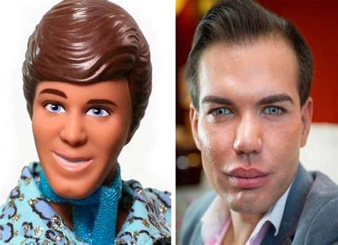 Plastic Surgery Ken Doll Before And After Pictures