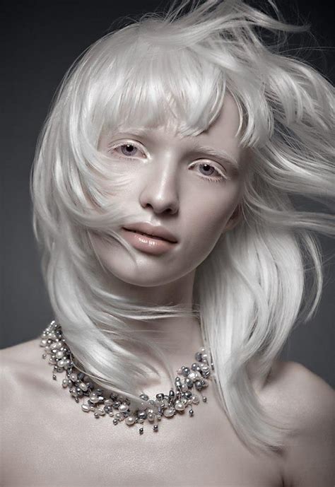 Albino Albinism Nastya Kumarova Pale Beauty Albino Model Albinism