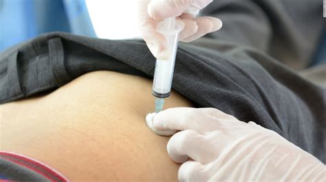 Illegal Butt Injections Carry Serious Health Risks Cnn