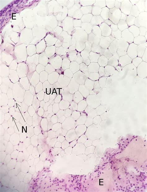 Unilocular Adipose Tissue 20x Histology