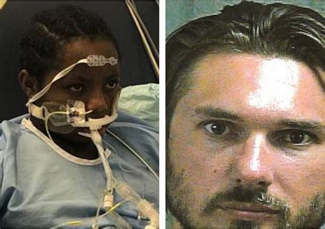 After Brutal Assault By White Man 12 Yr Old Congolese Girl In Texas Needs Heart Transplant