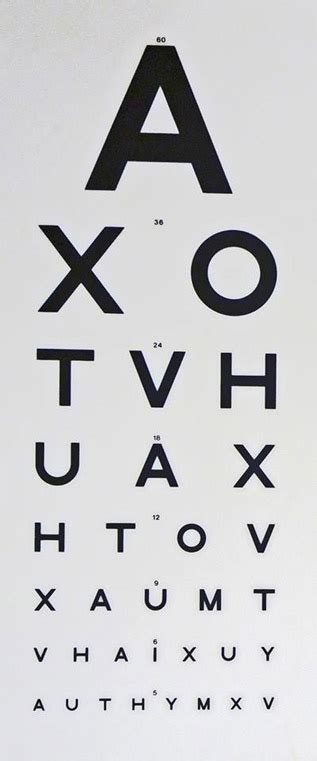 Eye Examinations Opticians Skewen Swansea Private Eye Care