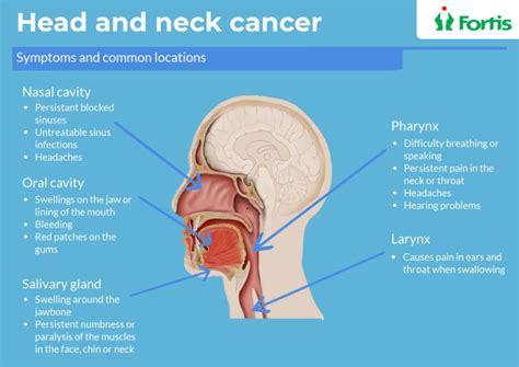 Pin On Head And Neck Cancer Treatments