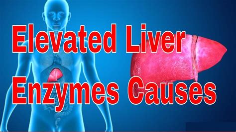 Elevated Liver Enzymes Causes Elevated Liver Enzymes High Liver