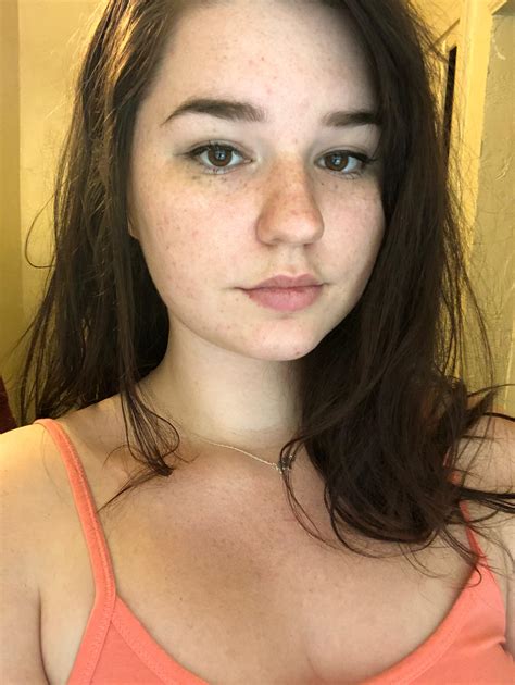 Check Out These New Summer Freckles Over R Selfie