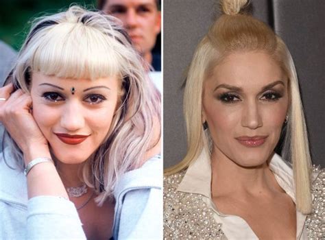 Gwen Stefani Before And After Celebrity Surgery Celebrity Plastic Surgery Plastic Surgery