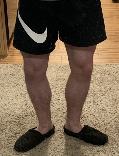 dillon on twitter got myself fucked up today realizing my calves are asymmetrical